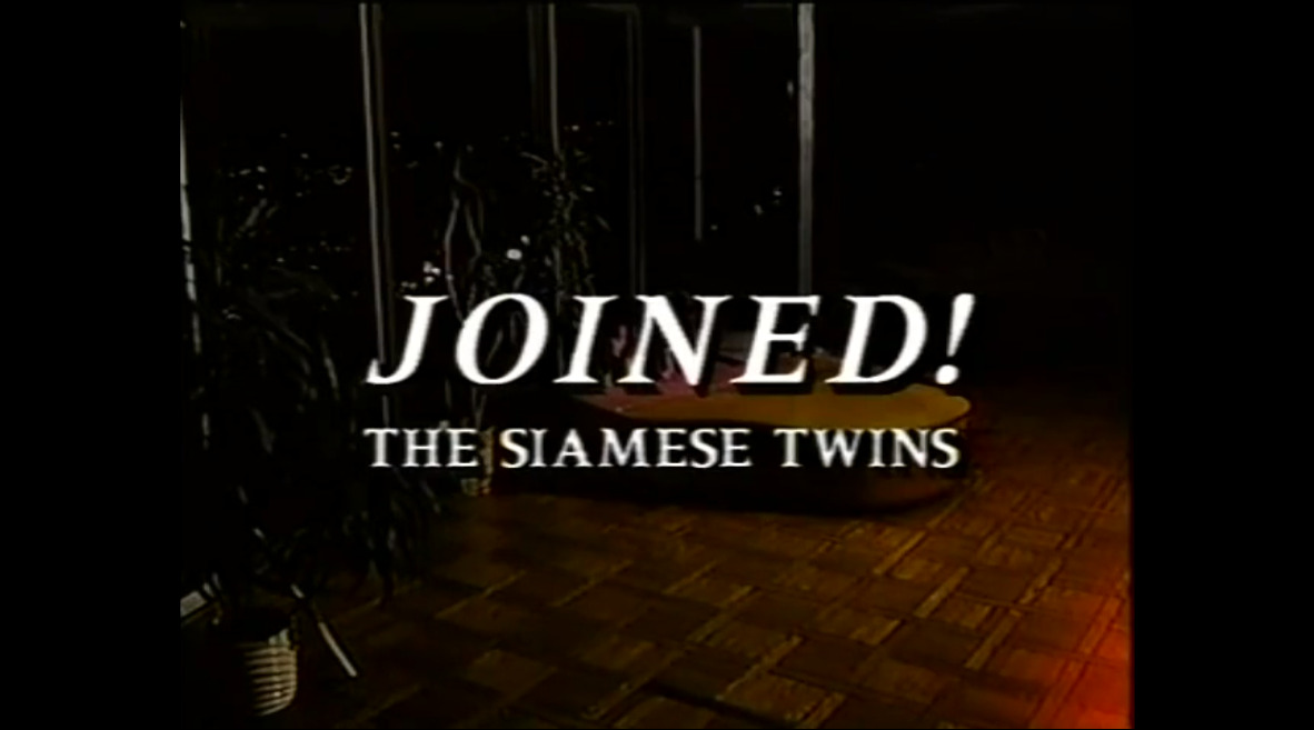 Joined! The Siamese Twins